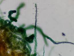 Attēlu rezultāti vaicājumam “Trichia botrytis var. cerifera”