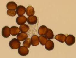 Attēlu rezultāti vaicājumam “Tranzschelia pruni-spinosae spores”
