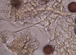 Attēlu rezultāti vaicājumam “Physarum bitectum”