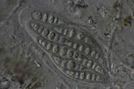 Attēlu rezultāti vaicājumam “Phaeographis dendritica”