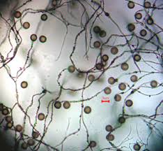 Attēlu rezultāti vaicājumam “Diderma deplanatum sessile”