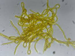Attēlu rezultāti vaicājumam “Diderma hemisphaericum young”