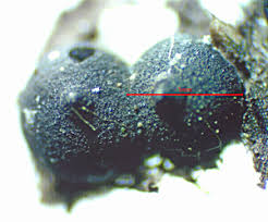 Attēlu rezultāti vaicājumam “Rosellinia desmazieri spores”