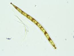 Attēlu rezultāti vaicājumam “Acrocordia gemmata”