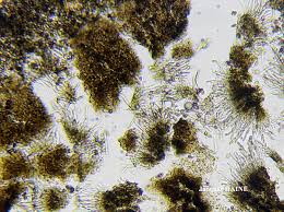 Attēlu rezultāti vaicājumam “Calicium adspersum”