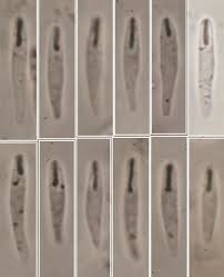 Attēlu rezultāti vaicājumam “Orbilia sp.”