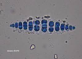 Attēlu rezultāti vaicājumam “Thelotrema lepadinum”