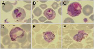 Attēlu rezultāti vaicājumam “Enteridium variabile plasmodium”