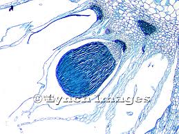 Attēlu rezultāti vaicājumam “Leiocolea rutheana sporophyte”