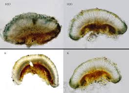 Attēlu rezultāti vaicājumam “Lecidella elaeochroma”