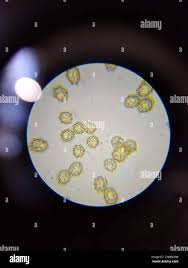 Attēlu rezultāti vaicājumam “Oligonema favogineum”