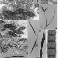 Attēlu rezultāti vaicājumam “Didymium annulisporum spores”