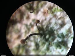 Attēlu rezultāti vaicājumam “Chaenotheca trichialis”