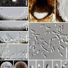Attēlu rezultāti vaicājumam “Diderma floriforme macro”