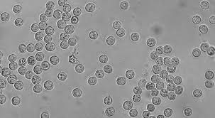 Attēlu rezultāti vaicājumam “Arcyria denudata spores”