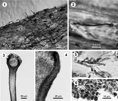 Attēlu rezultāti vaicājumam “Chaenotheca chlorella”