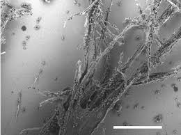 Attēlu rezultāti vaicājumam “Symphytocarpus flaccidus plasmodium”