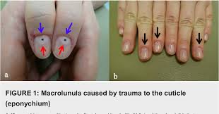 Image result for lunula nail