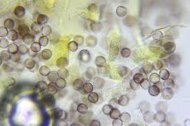 Attēlu rezultāti vaicājumam “Physarum daamsii sessile”