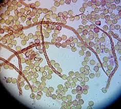 Attēlu rezultāti vaicājumam “Trichia botrytis var. cerifera”