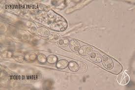 Attēlu rezultāti vaicājumam “Gyromitra infula”