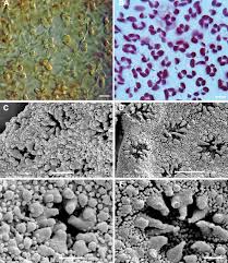 Attēlu rezultāti vaicājumam “Frullania fragilifolia macro”