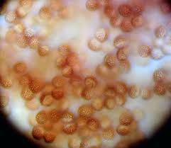 Attēlu rezultāti vaicājumam “Licea chelonoides spores”