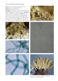 Attēlu rezultāti vaicājumam “Heterotrichia obvelata (syn. Arcyria obvelata) young”