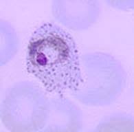 Attēlu rezultāti vaicājumam “Oligonema favogineum plasmodium”