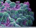 B0006421 Breast cancer cells | Flickr - Photo Sharing!