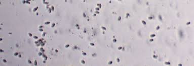 Attēlu rezultāti vaicājumam “Physarum penetrale stalked”