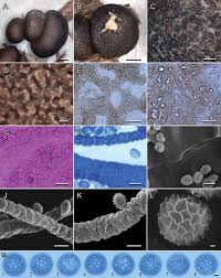 Attēlu rezultāti vaicājumam “Lycogala cf. fossiculatum young”
