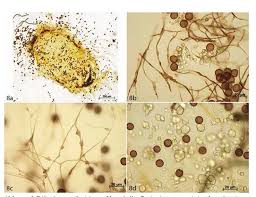 Attēlu rezultāti vaicājumam “Didymium tussilaginis spores”
