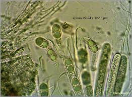 Attēlu rezultāti vaicājumam “Megalaria grossa”