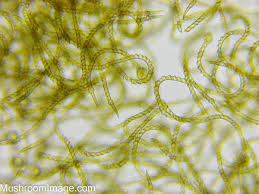 Attēlu rezultāti vaicājumam “Trichia contorta spores”