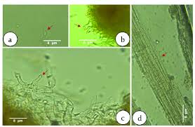Attēlu rezultāti vaicājumam “Marasmius sp.”