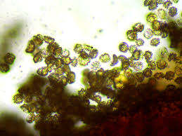 Attēlu rezultāti vaicājumam “Reticularia jurana spores”