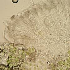 Attēlu rezultāti vaicājumam “Scoliciosporum chlorococcum”