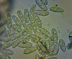 Attēlu rezultāti vaicājumam “Nectria peziza”