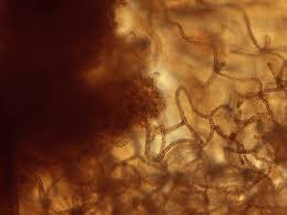 Attēlu rezultāti vaicājumam “Arcyria stipata young”