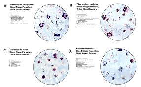 Attēlu rezultāti vaicājumam “Diachea muscorum plasmodium”