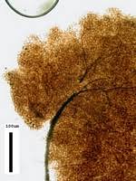 Attēlu rezultāti vaicājumam “Comatricha elegans spores”