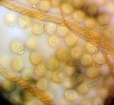 Attēlu rezultāti vaicājumam “Trichiaceae, Hemitrichiaceae, Arcyriaceae”