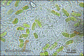 Attēlu rezultāti vaicājumam “Chaenotheca chlorella”