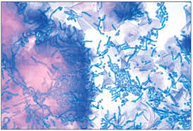 Attēlu rezultāti vaicājumam “Badhamia versicolor spores”