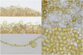 Attēlu rezultāti vaicājumam “Perichaena corticalis spores”