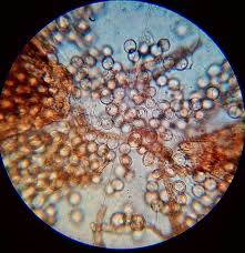 Attēlu rezultāti vaicājumam “Arcyria affinis”