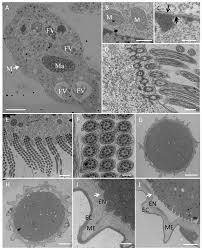 Attēlu rezultāti vaicājumam “Heterotrichia oerstedii (syn. Arcyria oerstedii) stalked”