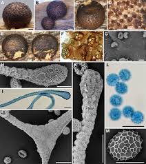 Attēlu rezultāti vaicājumam “Lycogala confusum spores”