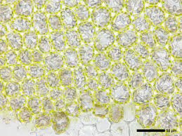 Attēlu rezultāti vaicājumam “Leiocolea rutheana cells”